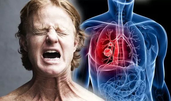 Symptoms Of Lung Cancer
